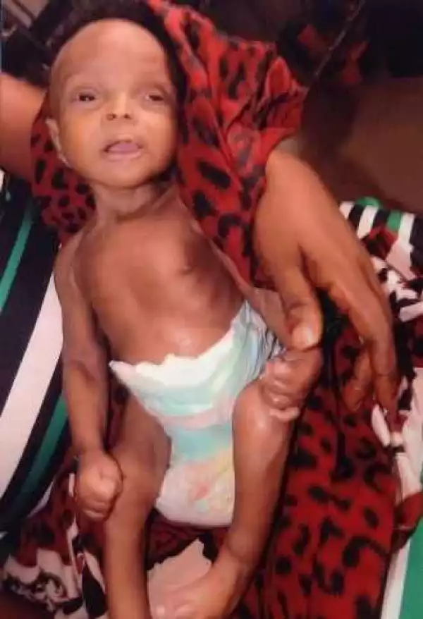 Baby born without anus, genitals born in Onitsha (photos)